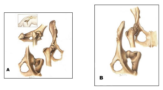 diagnosi precoce 2