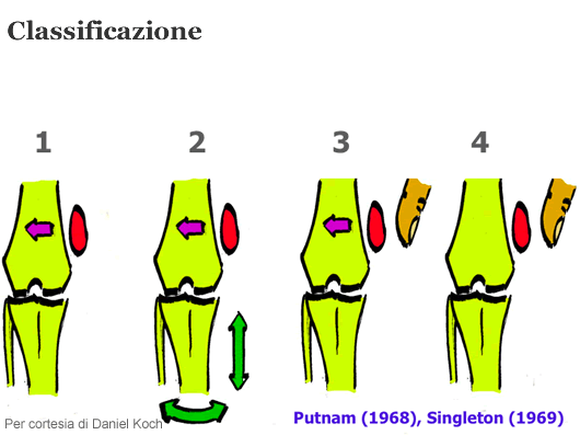 patolgie scheletriche lussazione 02