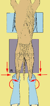 radiografico hd 01