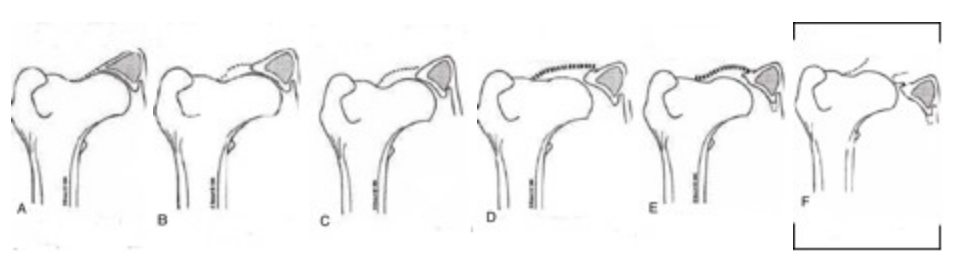 diagnosi precoce 3